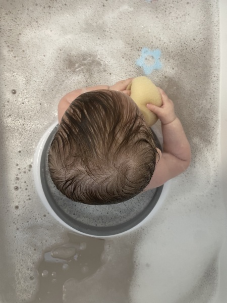 9 month old unusual head shape?