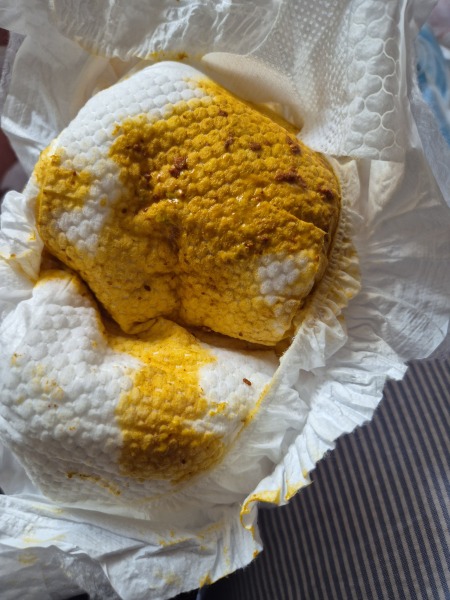 Does this look like blood? 11 day old EBF newborn nappy