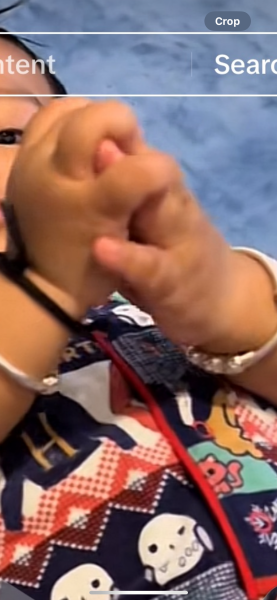 Rett syndrome hand wringing, 12 mo old
