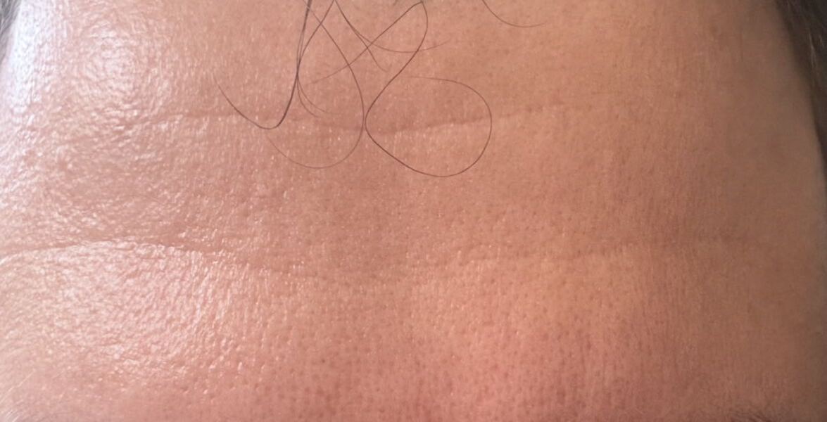 Why is my skin so bad?