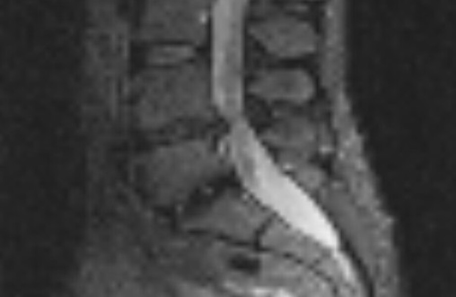 MRI image