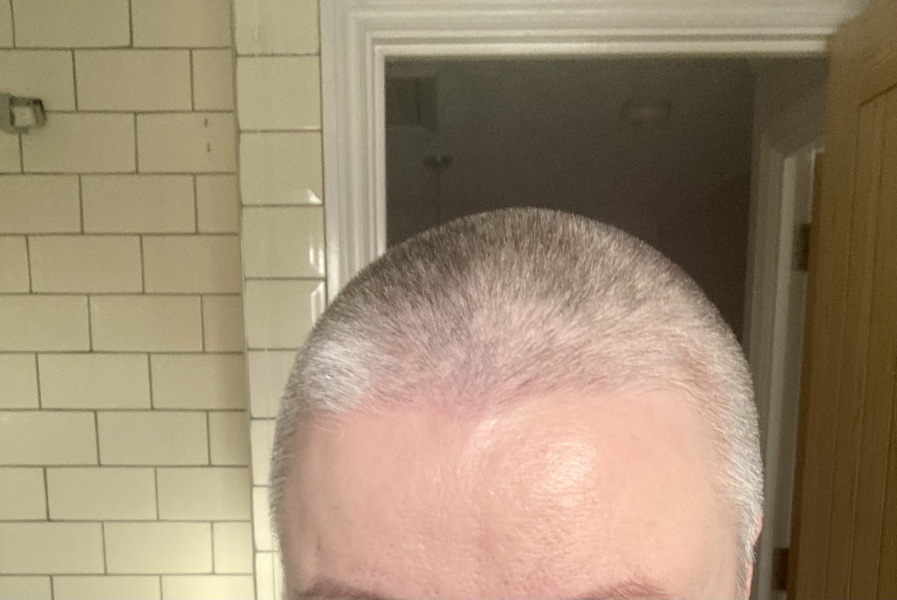 Is anyone else going grey this year?
