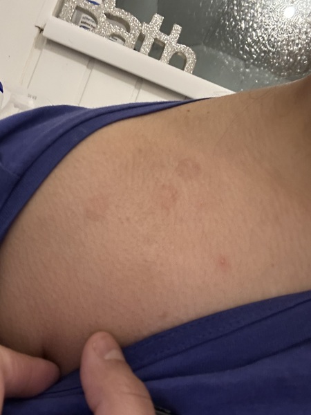 Anyone know what this is on my skin