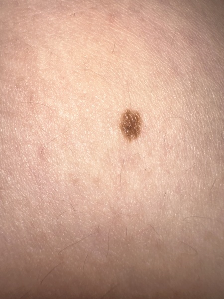 Moles