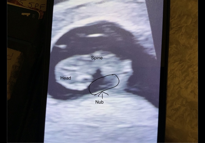 Facebook group have told me the sex at 8 weeks and 4 days?