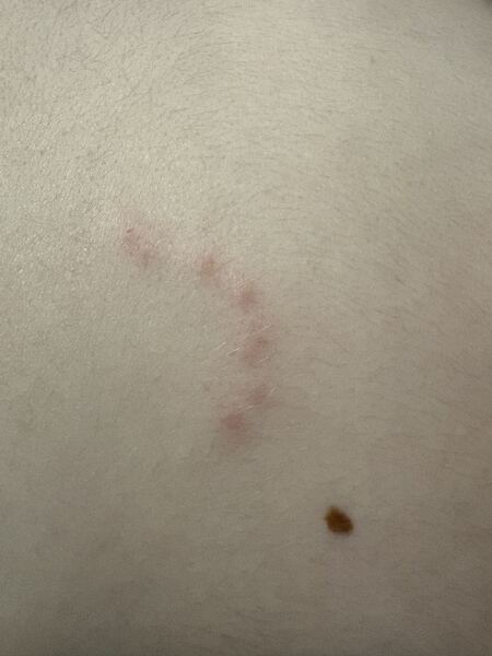 Any idea what this could be on my DS’s back