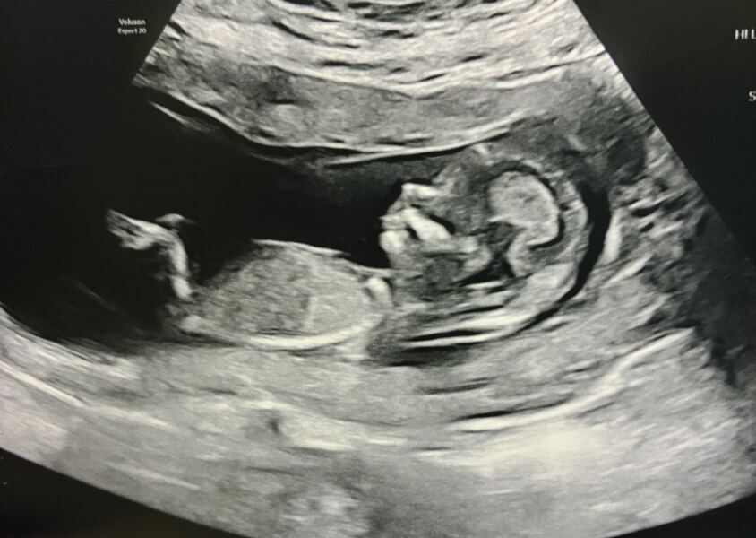 Boy or Girl 💙💕
