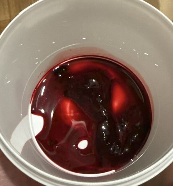 TW Miscarriage photo - is this the sac or just blood clot?