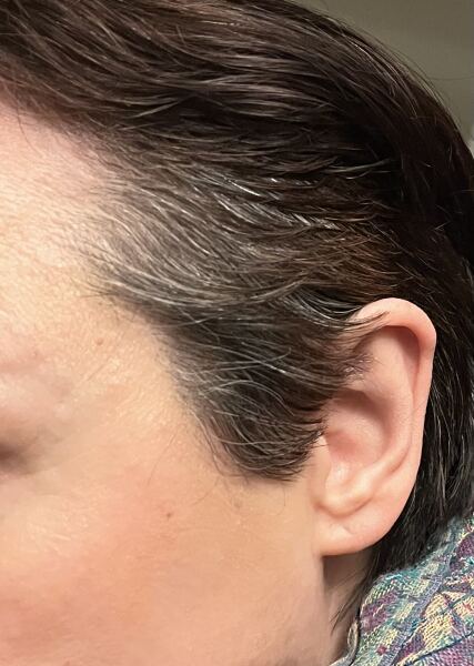 Is anyone else going grey this year?