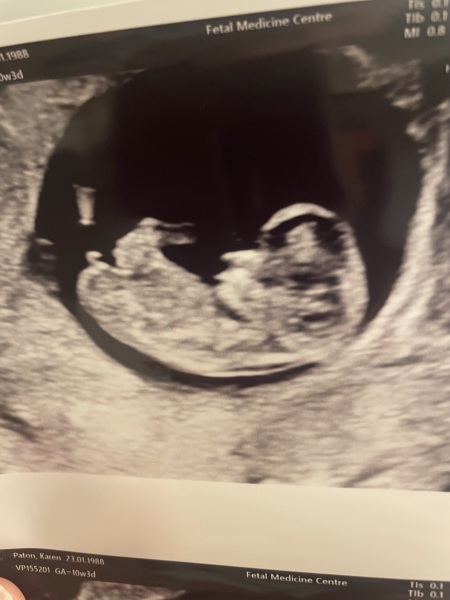 Guess the gender?
