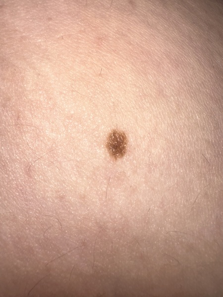 Moles