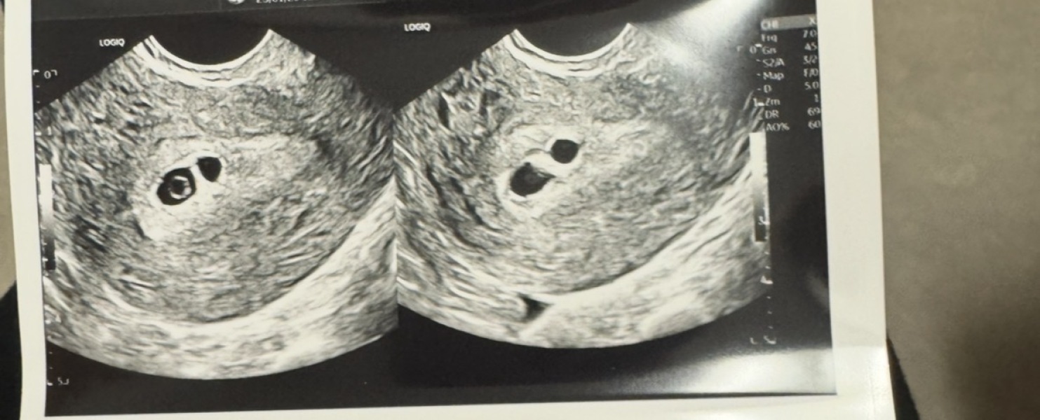 Brown and pink spotting 5 weeks