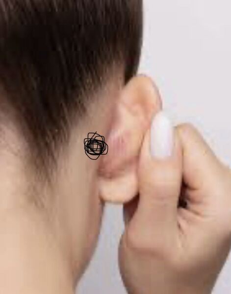 Do you have any lymph nodes behind your ears that have been there for years?