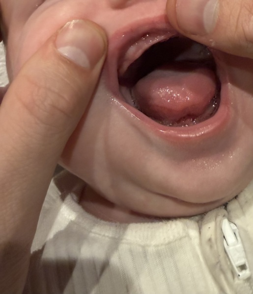 What’s normal for teething?