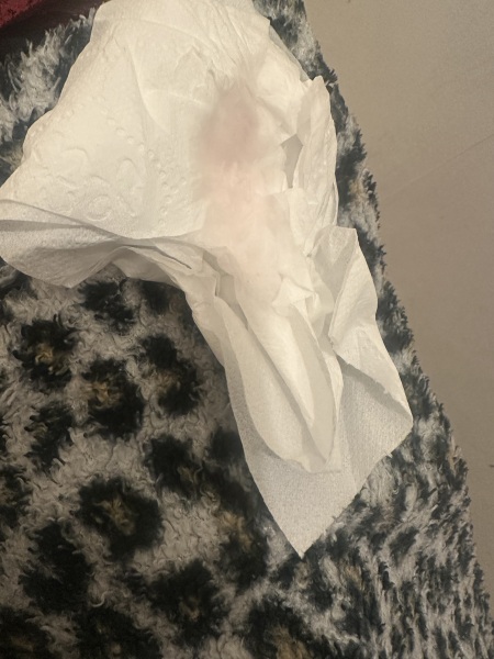 Pink spotting I’m on day 4 now!