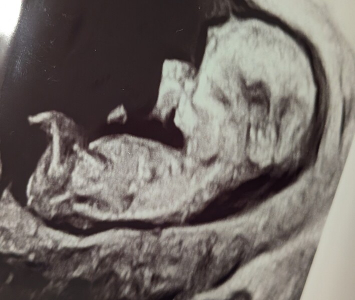 Baby sex guesses?