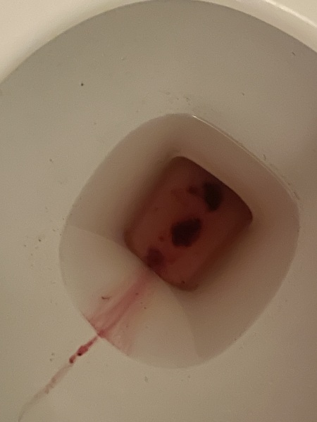 Got my period very early and had a strong pain I’m worried