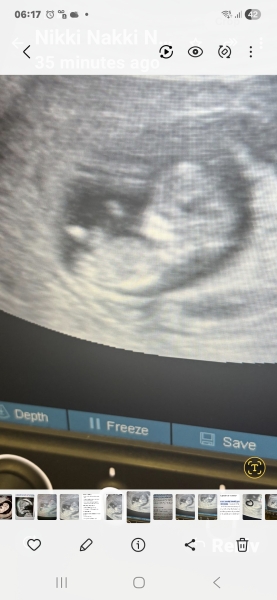 Boy or girl clues 11 weeks