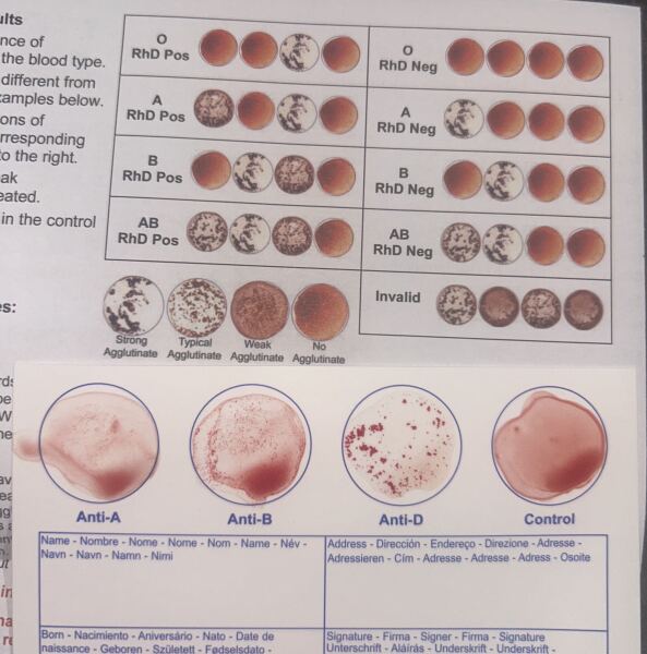 Blood group *picture inserted*