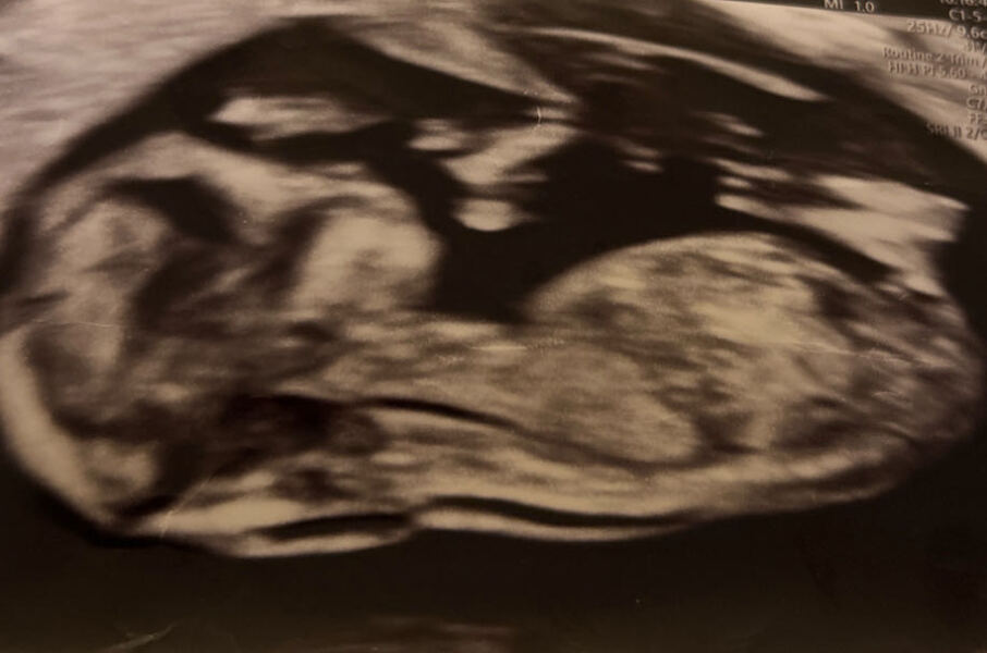 Boy or girl? Scan
