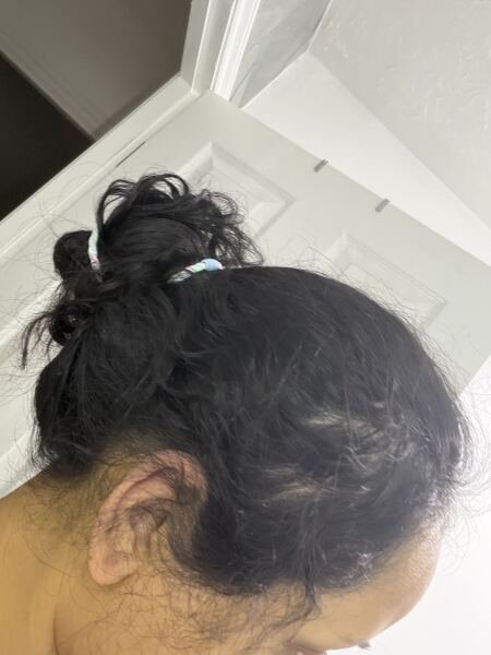 Hair loss. Please help!! Panic!