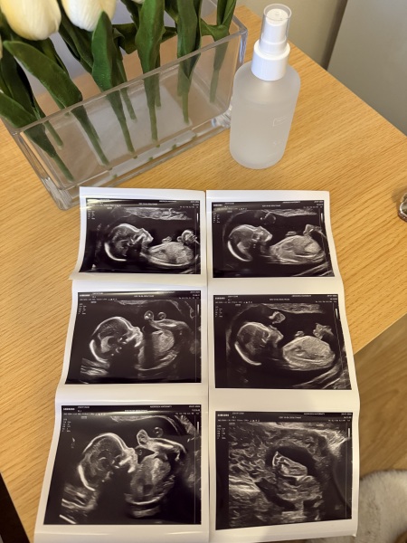 Boy or girl