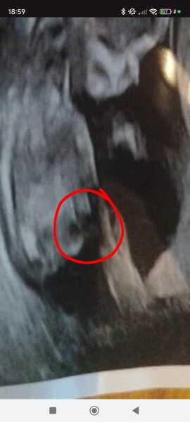 Very confused 🤔 nub theory