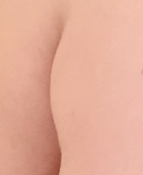 What is this lump?