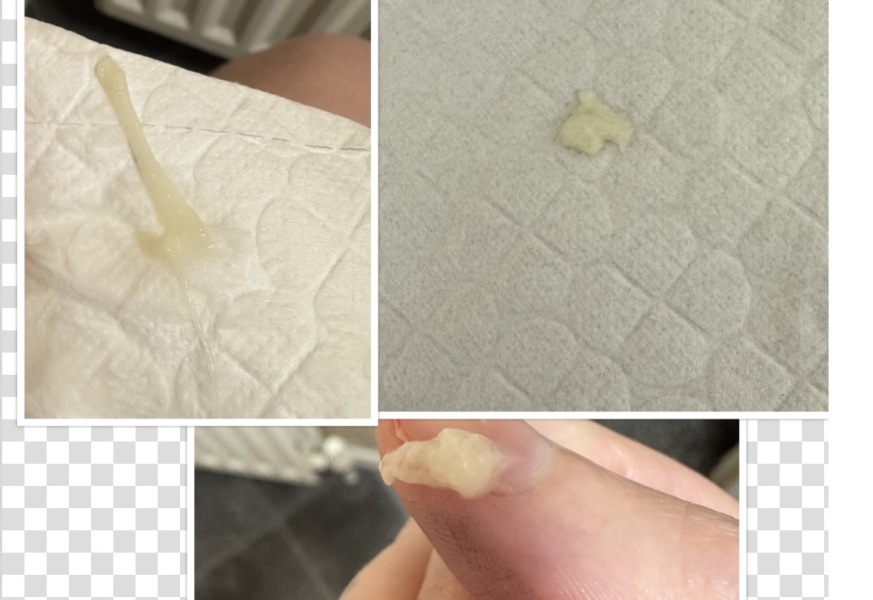 Discharge or mucus plug??? PICTURE