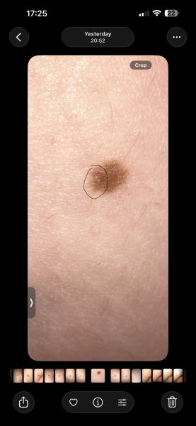 Moles