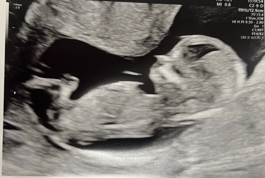 Guess the gender please! Pic attached