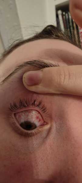 Pic of my daughter's eye - is this serious?