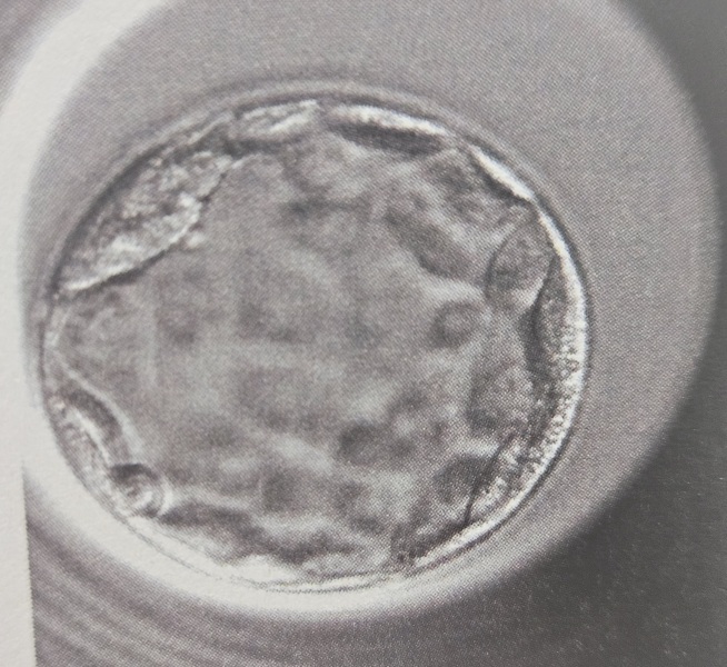 IVF Jan 2026
