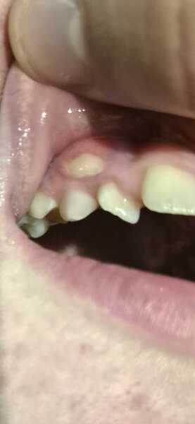 Does this look normal??