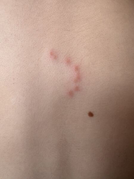 Any idea what this could be on my DS’s back