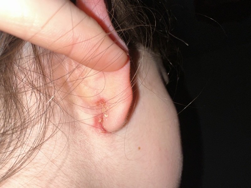To ask for your help with DD’s ear??  Pic attached.