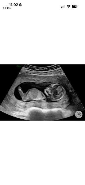 Scan predictions 💙💗