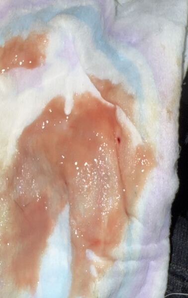 Spotting a week before period - WARNING IMAGE INCLUDED