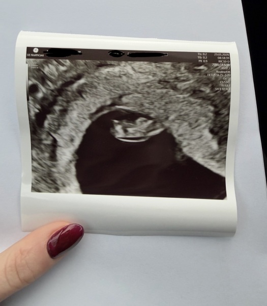 Due September 2026 🐣💖🙏🤞