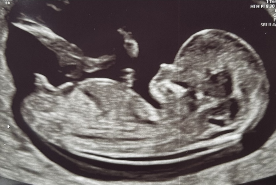Any guesses on gender please? 🥰