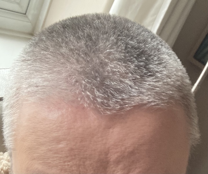 Is anyone else going grey this year?