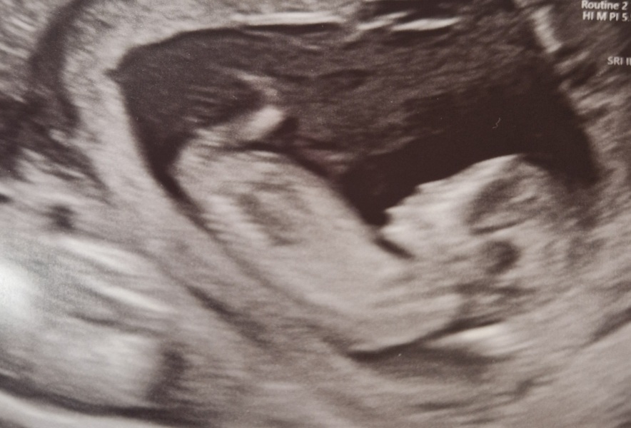 Guess the gender!