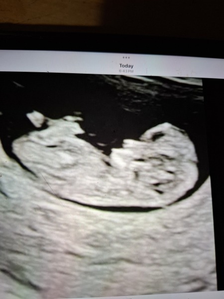 Fun guesses at 10 weeks 4 days