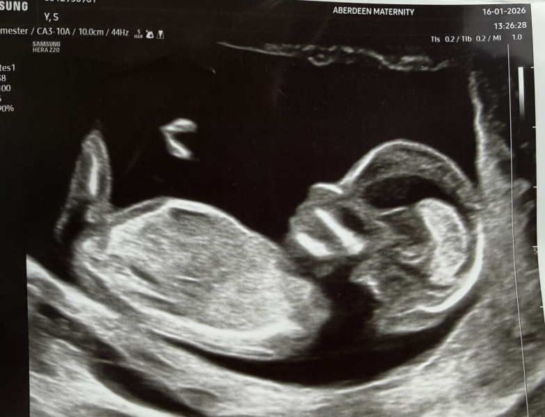 Nub theory gender prediction