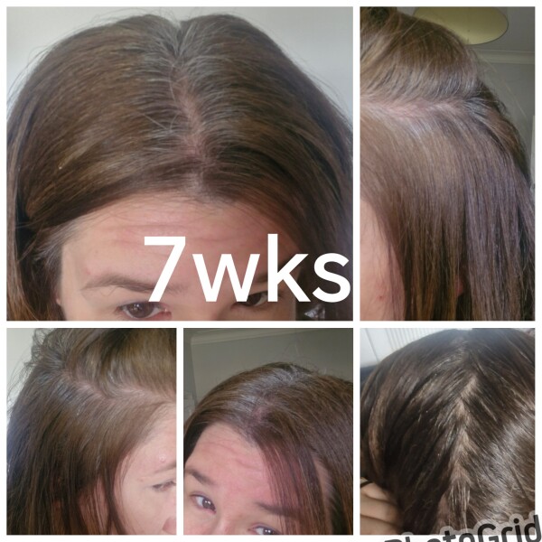 Is anyone else going grey this year?