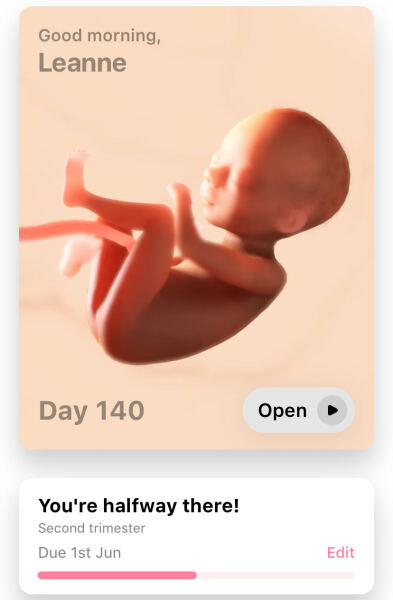 20 weeks today🩷