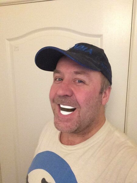 Teeth whitening but not expensive?