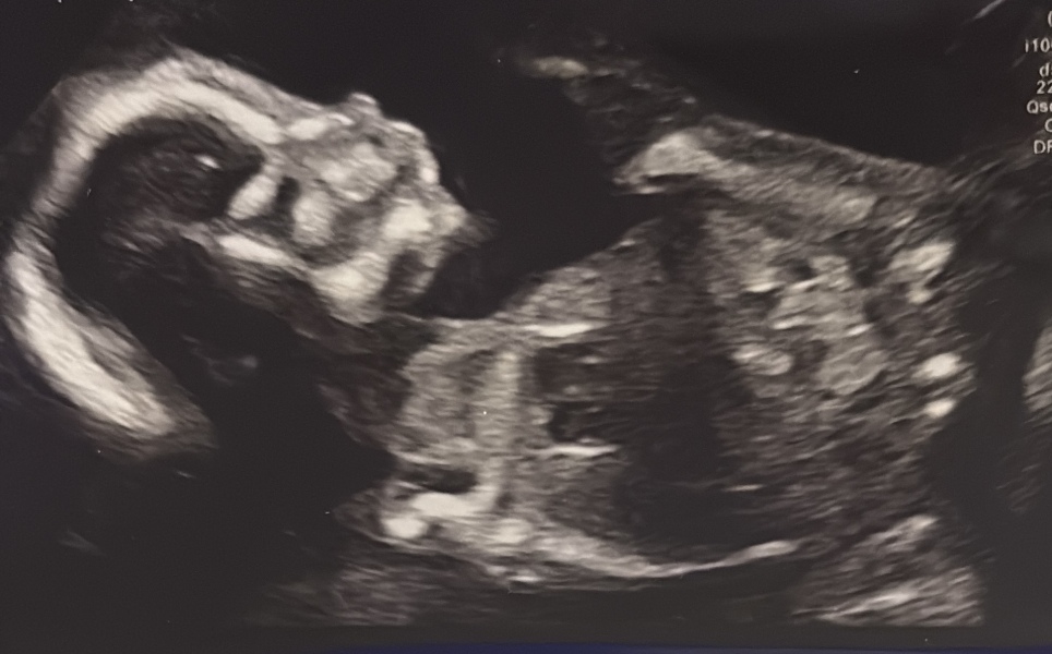 Girl or boy? 🩷💙