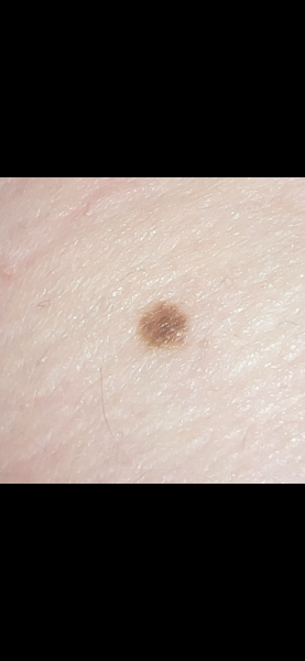 Mole