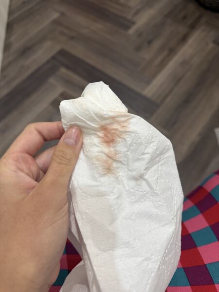 Implantation bleeding (picture included)